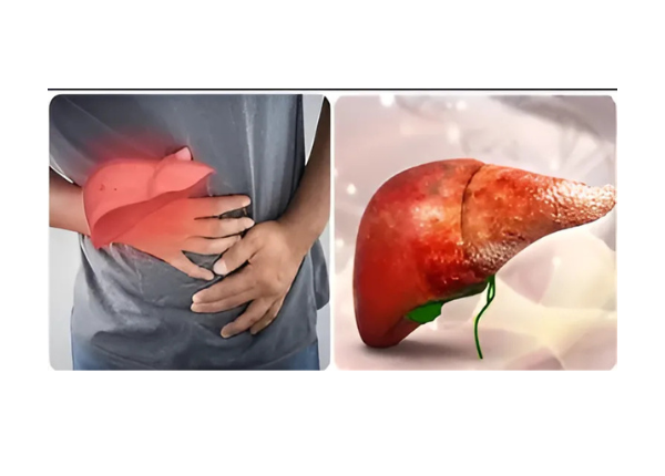 Viêm gan mạn tính là gì? Bệnh này có nguy hiểm không? 